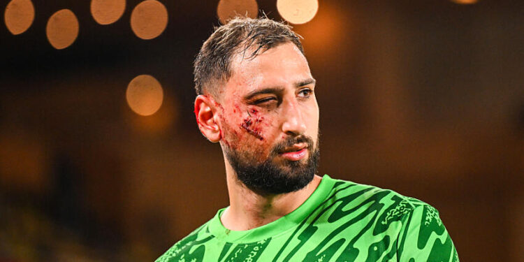 Gianluigi DONNARUMMA of Paris Saint-Germain get badly injured during the Ligue 1 McDonald's match between Monaco and Paris at Stade Louis II on December 18, 2024 in Monaco, Monaco.  (Photo by Anthony Bibard/FEP/Icon Sport)   - Photo by Icon Sport